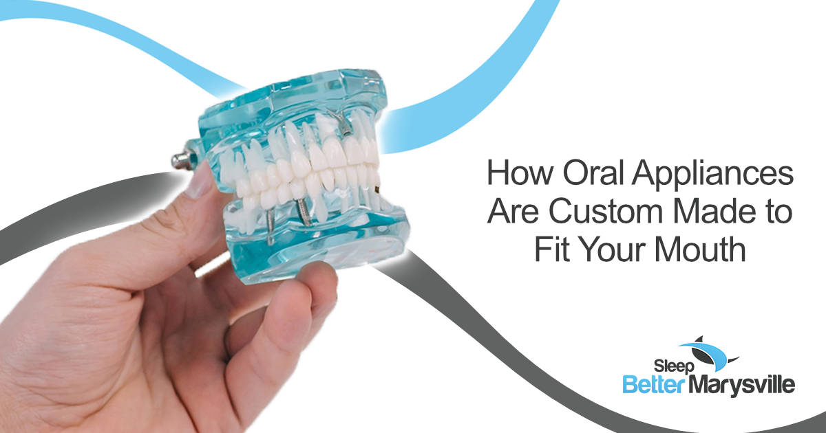 How Oral Appliances Are Custom Made to Fit Your Mouth